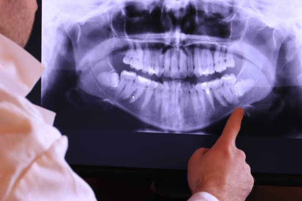 Best Emergency Dentist for Knocked-Out Tooth in Macopin, NJ